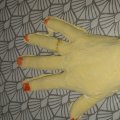 Kundbild Gipsbindor 5-pack: Gips hand som är målad sen
